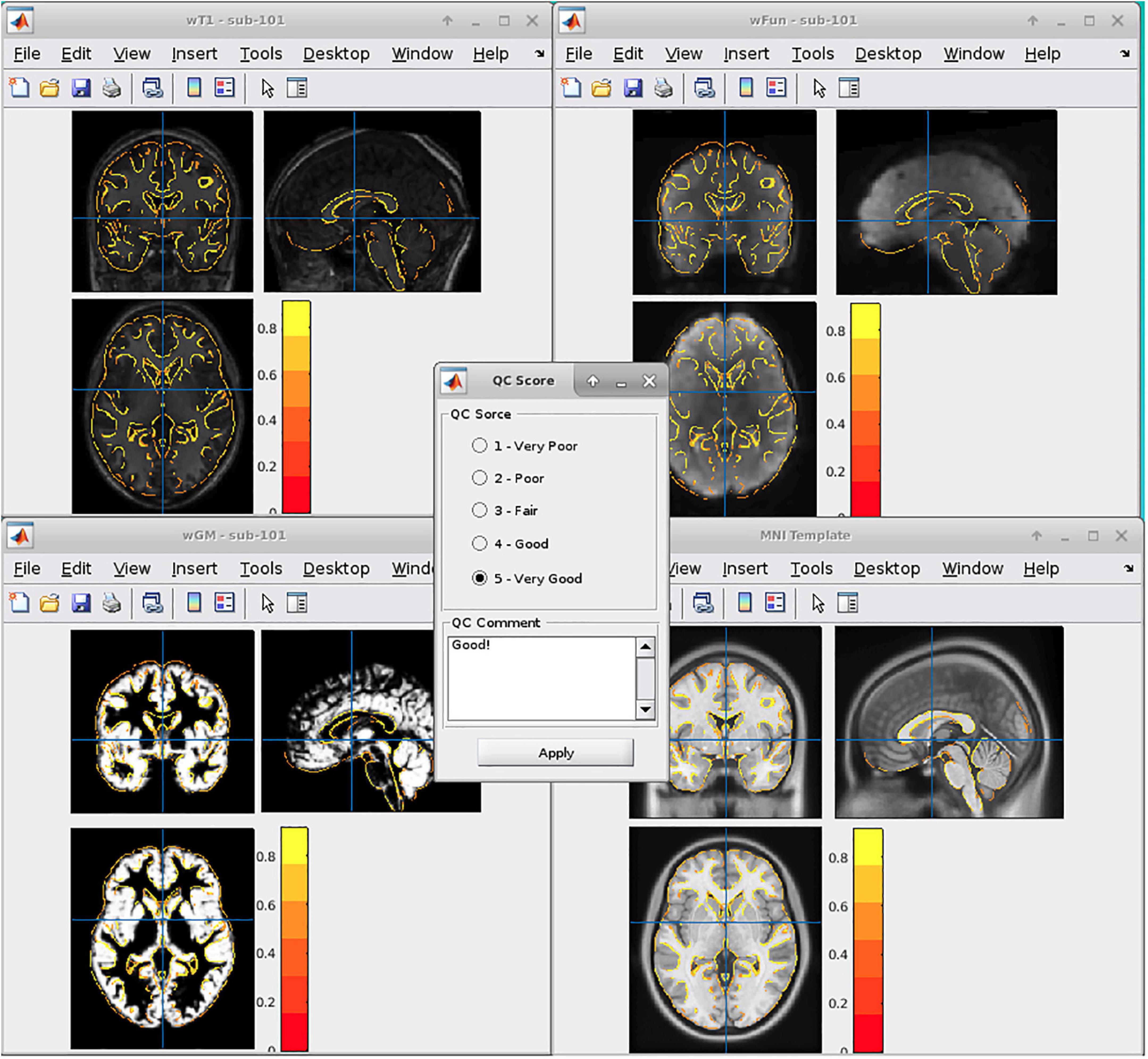 Demonstrating quality control procedures for fMRI in DPABI